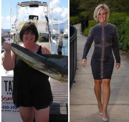 Dr Crystal's Before & After